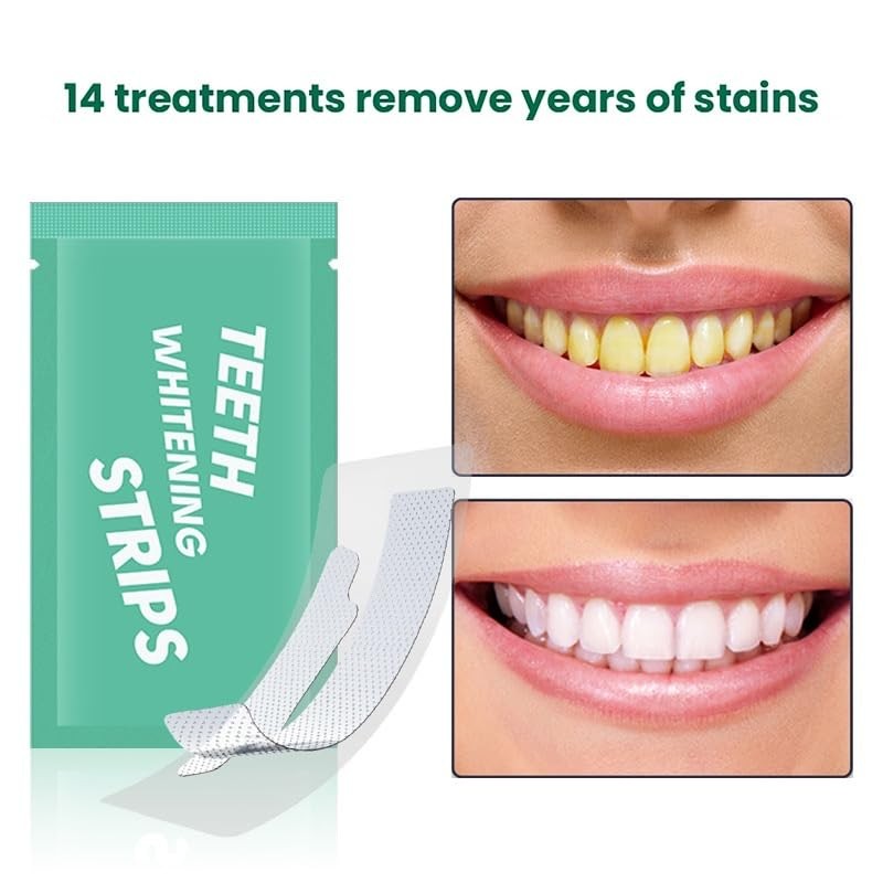 Teeth WHITENING Strips-Dentists FORMULATED-Residue Free-Non Sensitive-Enamel Safe-Mint FLAVOUR-14 Treatments 28