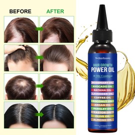 Technobeauty 11 in 1 Rosemary Oil With Black Castor, Batana, Lavender, Coffee, Coconut, Argan, Avocado, Olive, Almond & Parsley Seed, Infused for Ultimate Hair Growth & Care (Large 120 ml)