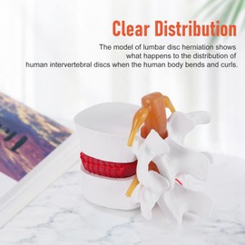 TOBEOME 1:1.5 Human Demonstration Model for Herniated Disc of the Lumbar Spine Model for Human Anatomy