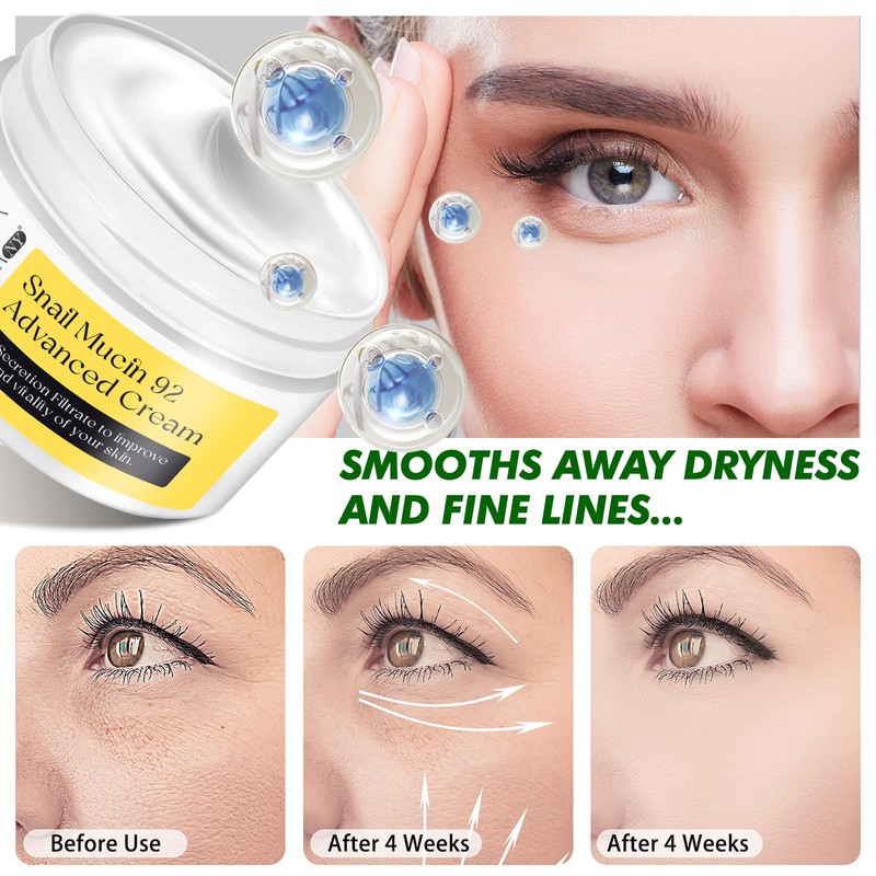 Snail Mucin 92% Face Moisturizer, natural treatment, Lightweight Moisturing Cream