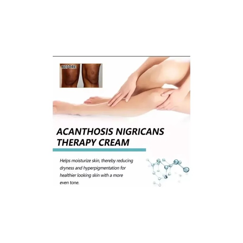 Crema Fixderma Nigrifix Para La Acantosis Nigricans Fbg Color Rojo