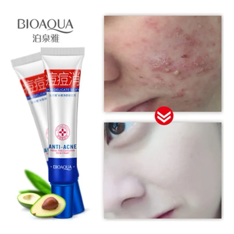 Bioaqua crema antiacné controla grasa y manchas, uso diario facial