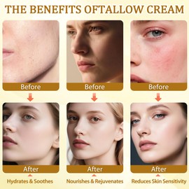 GARPGONA Beef Tallow for Skin, Whipped Tallow Cream for Face Moisturizer, 100% Grass Fed, Deeply Nourishing for Body, Smooth Soft for Dry Skin (Unscented)