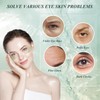 Under Eye Patches for Puffy Eyes and Dark Circles –