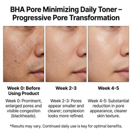 Maruderm Pore Minimiser Toner - Facial Toner Against Blackheads, Enlarged Pores, Wrinkles & Fine Lines | For Face, Body & Hair | For All Skin Types 250 ml