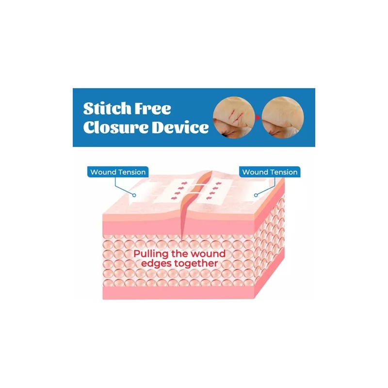 Tiras De Cierre Heridas De Emergencia,vendaje Puntada 4pcs
