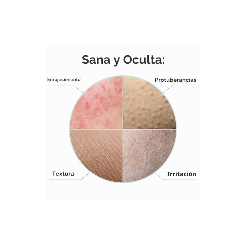 PROcure Rosacare máscara calmante de hoja con extracto de regaliz,