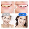 21 Piezas Tiras Bandas Blanqueadoras Tratamiento Dental 5d
