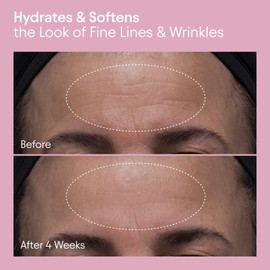 Alpyn PlantGenius Melt Moisturizer | Weightless Rich Cream Targeting Dry, Dehydrated Skin with Lasting Hydration and a Velvety, Makeup-Ready Finish | 1.7 oz / 50 ml