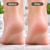 2 Pcs Nano Glass Foot File for Heel Exfoliation –