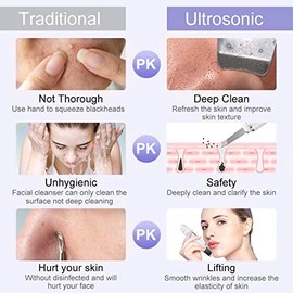 ANLAN Peeling Ultrasónico Facial Skin Scrubber Exfoliación Facial Ultrasónica Limpiador de Poros para Limpieza Facial y Cuidado Facial