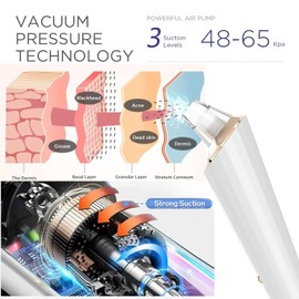 Blackhead Remover Pore Vacuum, Upgraded USB Rechargeable Facial Pore Cleaner Blackhead Removal Kit with 3 Suction Power,5 Probes Black Head Extractions Tool for Women & Men