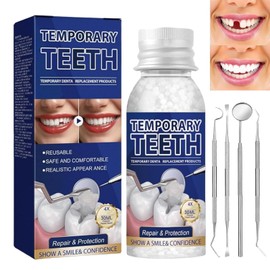 30ML Temporary Tooth Filling,Moldable False Teeth for Fixing,Temporary Tooth Repair Kits,Filling Missing Broken Tooth,False Teeth Replacement Tooth Filling Repair Kits,Missing Teeth Replacement Kit