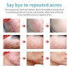 Mz . Facial Reafirmante Hidratante Activo Antiarrugas Fade