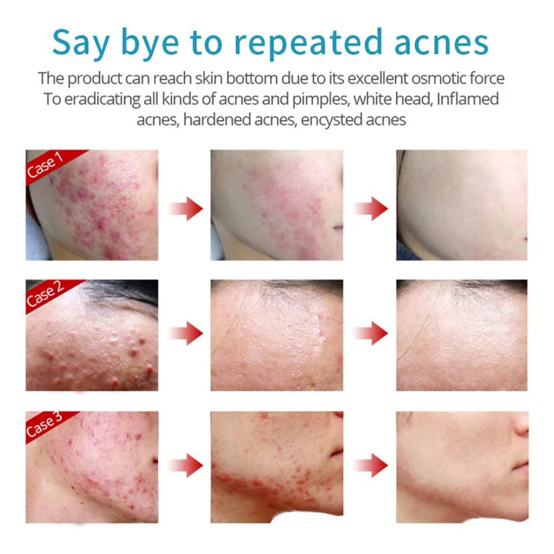 Mz . Facial Reafirmante Hidratante Activo Antiarrugas Fade