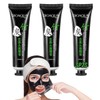 3 Piezas - Mascarilla Carbon Activado Puntos Negros Skin Care
