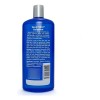 Solucin Para El Cuidado De La Piel Skincare Tend 473