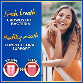 Dental Probiotics for Teeth and Gums - 3BN CFU Lactobacillus Salivarius Acidophilus Casei Tablets - Oral Probiotics for Mouth Bad Breath Treatment for Adults - 45 Chewable Dental Probiotic in a Tin