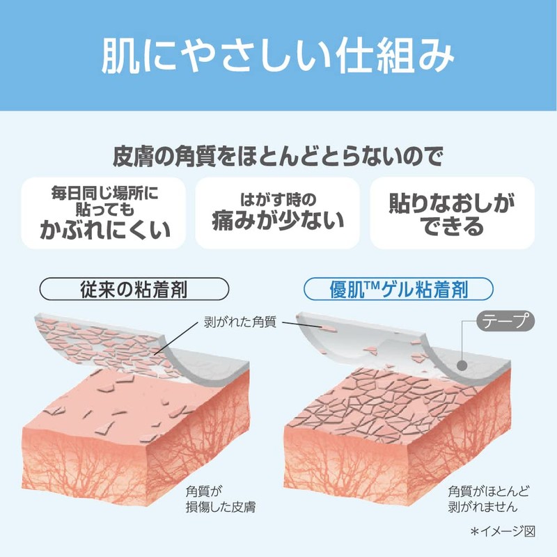 Nitoms H24R10 Yu-Skin Permirol, 3.9 inches (10 cm) x 32.8