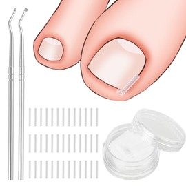 WUSJCOF 100 Pieces Ingrown Toenail Correction Set - Painless Toenail Straightening Strips with Toenail Lifter - Simple Ingrown Toenail Tool Kit