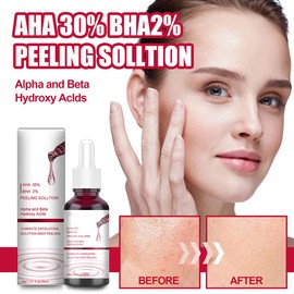 Peeling Solution,AHA 30% + BHA 2% Peeling Solution Fruit Acid Essence Liquid Exfoliating Pores Shrinks Facial Care Serum