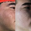 Pack x2 Jabones Aclarantes De Mi Má Ácido Kojico