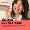alessandro SOS Nail Repair Serum - Nail Serum for Brittle