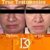 Limpiador Facial Exfoliante con Ácido Glicólico al 10% y Niacinamida