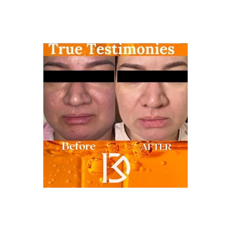 Limpiador Facial Exfoliante con Ácido Glicólico al 10% y Niacinamida