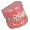 Demonstration Orthodontics Dental Model Disassembled Resin Teeth Model for Teaching