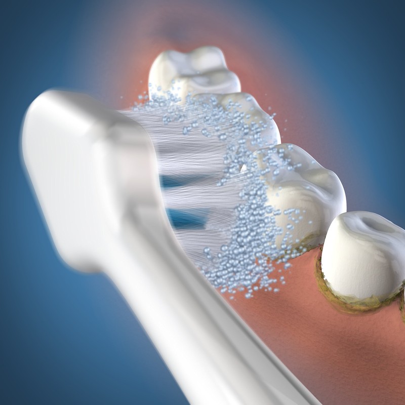 Waterpik Triple Sonic Brush Heads Replacement Brush Heads for Complete