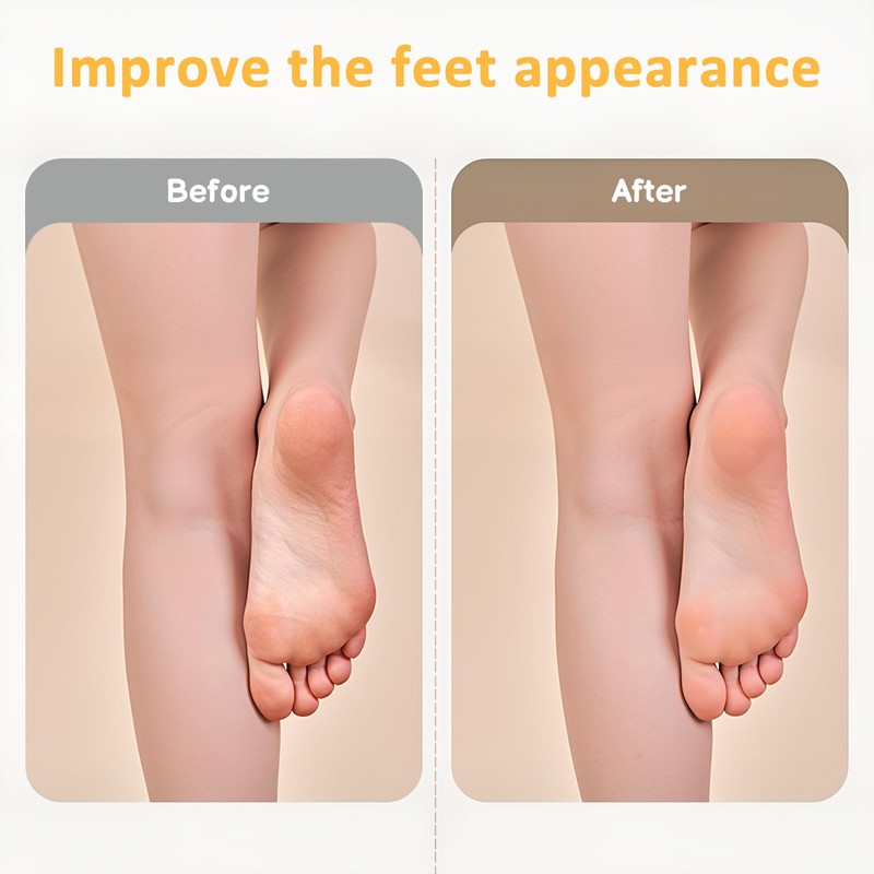 8 Pairs Moisturizing Socks Overnight, Lotion Socks for Dry Feet,