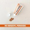 Acnomel Acné En Adultos Crema Medicamento 36g Importado