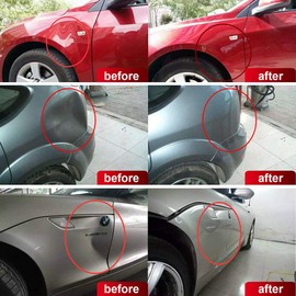 WUPP Paintless Car Dent Repair Tools, Auto Body Dent Removal kit Dent Puller Set for Hail Damage Door Dings Repair