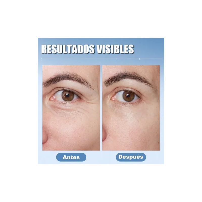 Crema Para El Contorno De Los Ojos Ácido Hialurónico 15