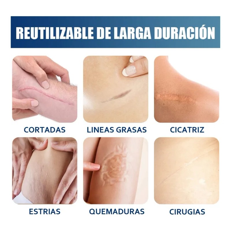 Gel De Silicona Para Eliminar Cicatrices De Cesárea Estrías Neutra