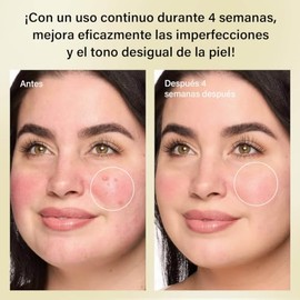 Ácido Azelaico al 10% Crema Facial, 50g