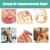 Esshogo 1 Set Ingrown Toenail Tools, Nail Correction Buckle, Patch