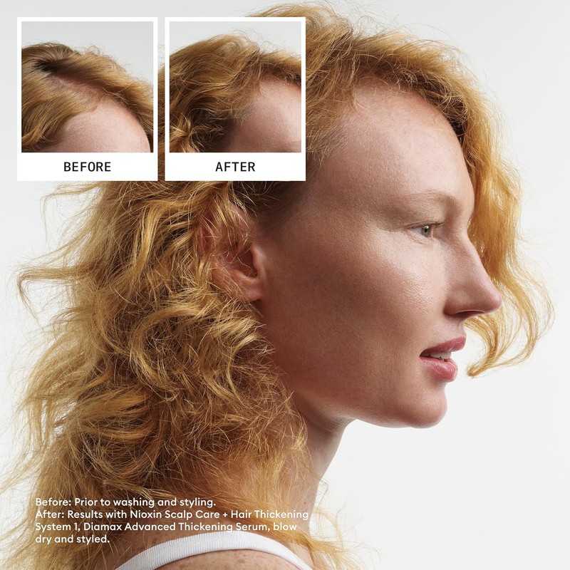 Nioxin Cleanser Shampoo System 1 for Fine Hair with Light