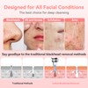 Blackhead Remover Pore Vacuum Upgraded Facial Pore Cleaner Electric Comedone