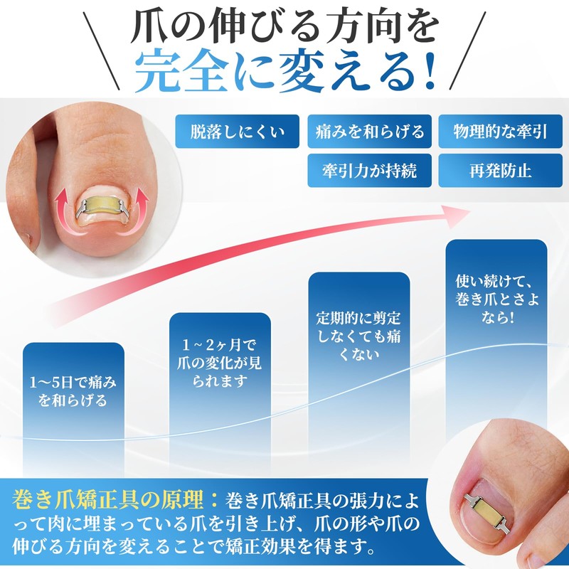 Watles Nail Curling Corrector, Gentle Rubber Force Traction Nail Pain