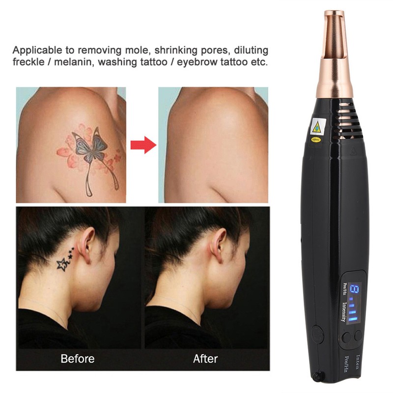 Blue Light Picosecond Pen Scar Tattoo Removal Pen For Melanin