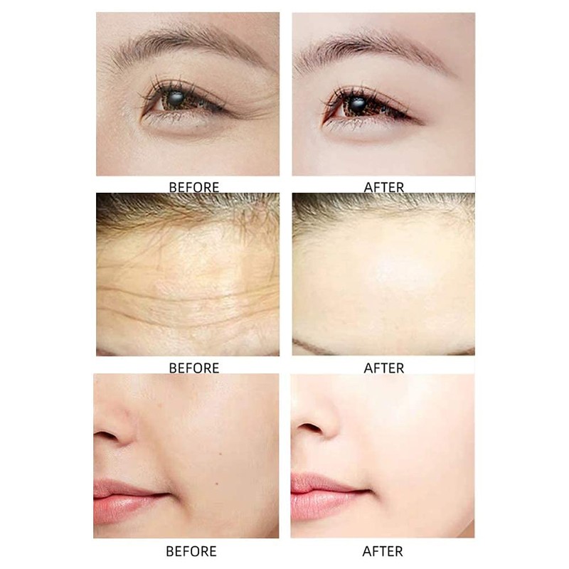 SEGMINISMART Nail Anti Wrinkle Patches 15ml