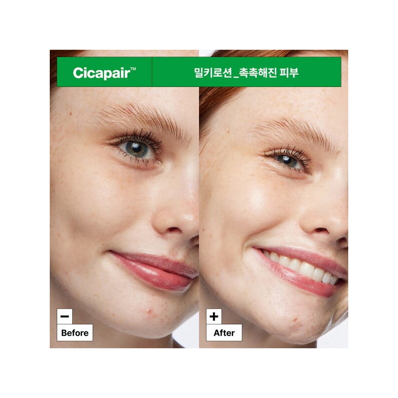 Dr. Jart+ 닥터자르트 시카페어 인텐시브 수딩 리페어 밀키 로션 100ml
