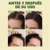 Aceite Vegano Natural Para El Crecimiento Del Cabello