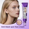 Spot Treatment Cream,Anti Pigmentation Face Cream,Pigmentation Removal Cream,Advanced Anti-Hyperpigmentation Crea-m