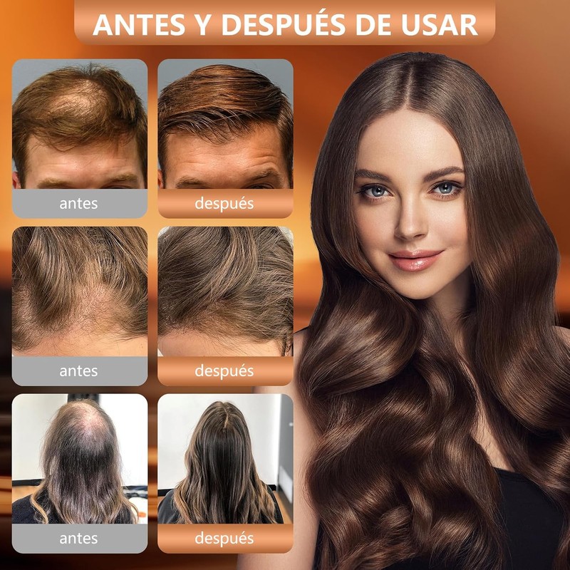 Champú Hair Shampoo，Champú Anticaída de Jengibre