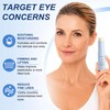 Under Eye Balm Stick for Dark Circles & Puffiness
