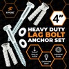 xpose safety Concrete Anchors Set with 4"" Lag Bolt, Lag