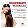 Aurisova Gomitas Cabello Piel Uñas Biotina 6000 Mcg